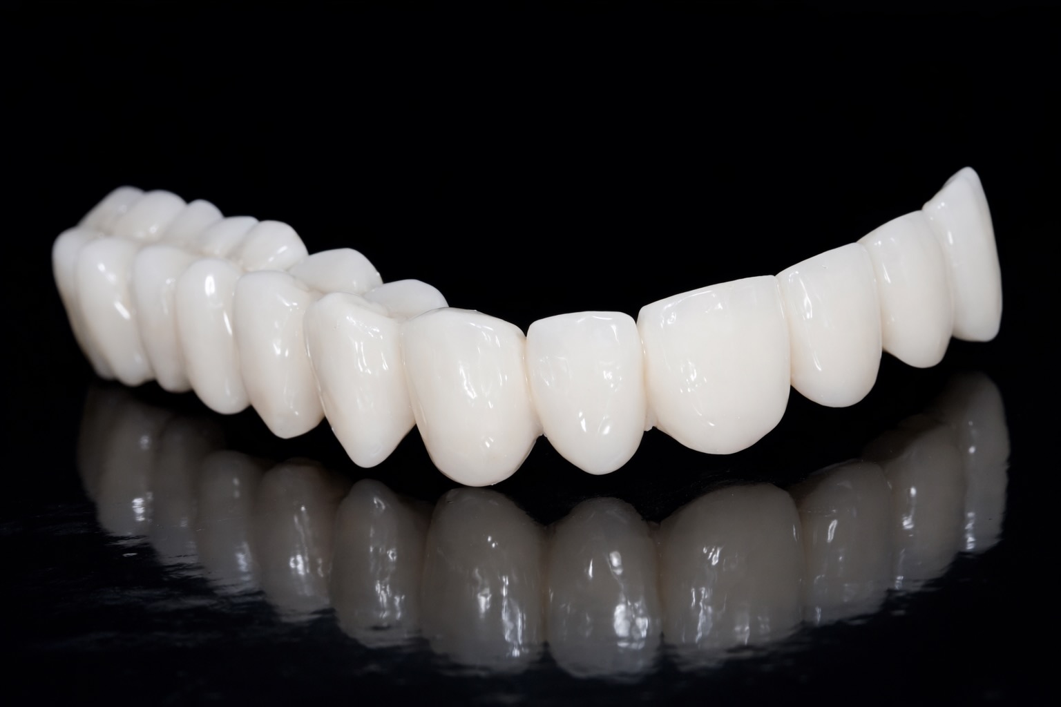 Vollkeramische Arbeiten im Zahnlabor De Fazio